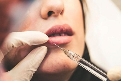 Lip Injections in Riyadh Subtle Enhancement Experts